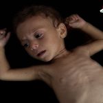 وفاة الطفل الغزاوي صاحب صرخة "أنا جعان" في تركيا